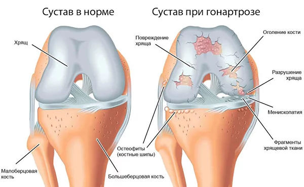 случайные оголения в спорте нарезка видео / X